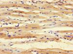 SMNDC1 Polyclonal Antibody