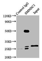SMNDC1 Antibody in Immunoprecipitation (IP)