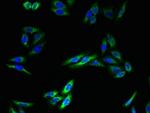 TMEM140 Polyclonal Antibody