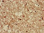 TMEM161B Antibody in Immunohistochemistry (Paraffin) (IHC (P))