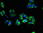 TMEM31 Polyclonal Antibody
