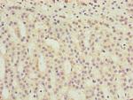TMEM31 Antibody in Immunohistochemistry (Paraffin) (IHC (P))