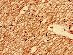 TMEM47 Antibody in Immunohistochemistry (Paraffin) (IHC (P))