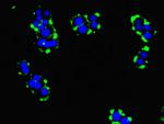 TMEM95 Polyclonal Antibody