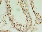 PIN1 Polyclonal Antibody