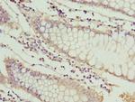 MT1G Polyclonal Antibody