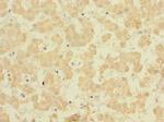 FAM187B Antibody in Immunohistochemistry (Paraffin) (IHC (P))