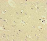 TXNDC8 Polyclonal Antibody