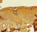 LCE2A Polyclonal Antibody