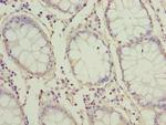 ZNF767P Polyclonal Antibody