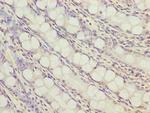 ZNF767P Antibody in Immunohistochemistry (Paraffin) (IHC (P))