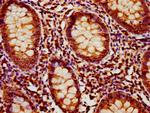 MOB1B Antibody in Immunohistochemistry (Paraffin) (IHC (P))