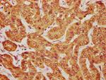 MOB1B Antibody in Immunohistochemistry (Paraffin) (IHC (P))