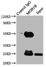 MOB1B Antibody in Immunoprecipitation (IP)