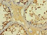 BAGE3 Antibody in Immunohistochemistry (Paraffin) (IHC (P))
