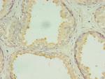 CCDC135 Antibody in Immunohistochemistry (Paraffin) (IHC (P))
