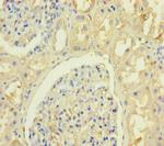 KRTAP8-1 Polyclonal Antibody