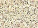WFDC11 Polyclonal Antibody
