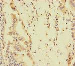 SPEM1 Polyclonal Antibody