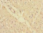 PPM1E Polyclonal Antibody