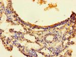 ZNF738 Antibody in Immunohistochemistry (Paraffin) (IHC (P))