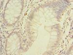 SSMEM1 Antibody in Immunohistochemistry (Paraffin) (IHC (P))
