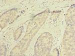 SSMEM1 Antibody in Immunohistochemistry (Paraffin) (IHC (P))