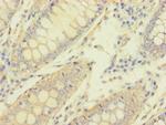 MACROD1 Polyclonal Antibody