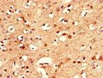 CLSTN2 Antibody in Immunohistochemistry (Paraffin) (IHC (P))
