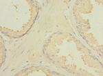 CXorf21 Antibody in Immunohistochemistry (Paraffin) (IHC (P))