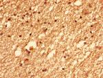CEP126 Antibody in Immunohistochemistry (Paraffin) (IHC (P))
