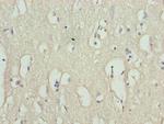 RHPN1-AS1 Antibody in Immunohistochemistry (Paraffin) (IHC (P))