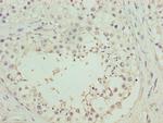 RHPN1-AS1 Polyclonal Antibody