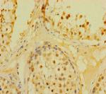 DUSP21 Antibody in Immunohistochemistry (Paraffin) (IHC (P))