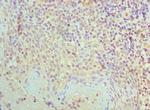 SMC1 Polyclonal Antibody