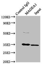 MAGE1 Antibody in Immunoprecipitation (IP)