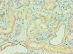 C4BPB Polyclonal Antibody