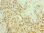 Metadherin Polyclonal Antibody