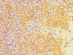 Metadherin Antibody in Immunohistochemistry (Paraffin) (IHC (P))