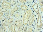 FUT6 Polyclonal Antibody