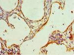 HMGN4 Polyclonal Antibody