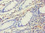 AES Antibody in Immunohistochemistry (Paraffin) (IHC (P))
