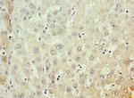 MKS1 Polyclonal Antibody