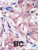 JNK3 Polyclonal Antibody