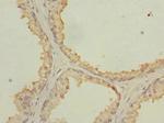 NMT2 Polyclonal Antibody