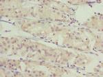 SLC46A1 Polyclonal Antibody