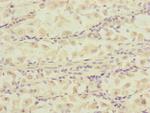 DCTN6 Polyclonal Antibody
