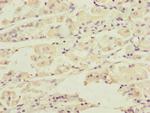 DCTN6 Polyclonal Antibody