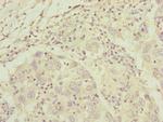 C8A Polyclonal Antibody