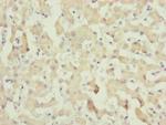 C8A Antibody in Immunohistochemistry (Paraffin) (IHC (P))